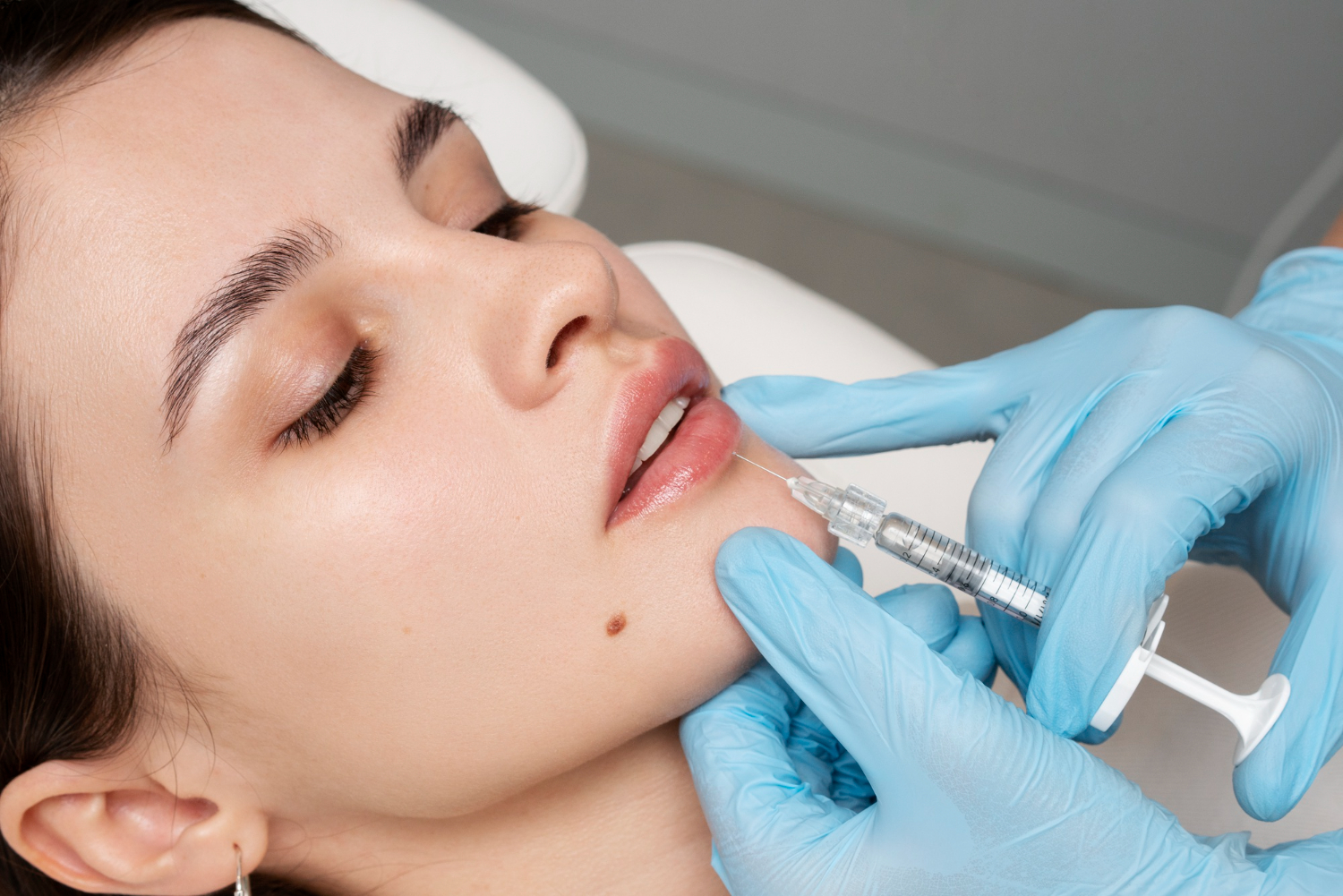 How to Choose the Right Dermal Filler